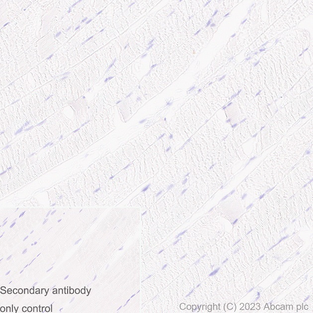Immunohistochemistry (Formalin/PFA-fixed paraffin-embedded sections) - Anti-UBE2I / UBC9 antibody [EP2938Y] (ab75854), expandable thumbnail
