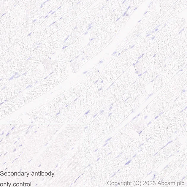 Immunohistochemistry (Formalin/PFA-fixed paraffin-embedded sections) - Anti-UBE2I / UBC9 antibody [EP2938Y] (AB75854)