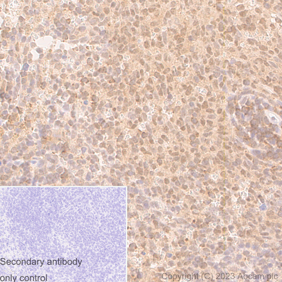 Immunohistochemistry (Formalin/PFA-fixed paraffin-embedded sections) - Anti-UBE2I / UBC9 antibody [EP2938Y] (ab75854), expandable thumbnail