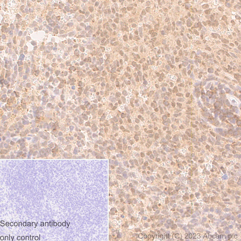 Immunohistochemistry (Formalin/PFA-fixed paraffin-embedded sections) - Anti-UBE2I / UBC9 antibody [EP2938Y] (AB75854)