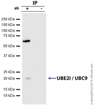 Immunoprecipitation - Anti-UBE2I / UBC9 antibody [EP2938Y] (AB75854)