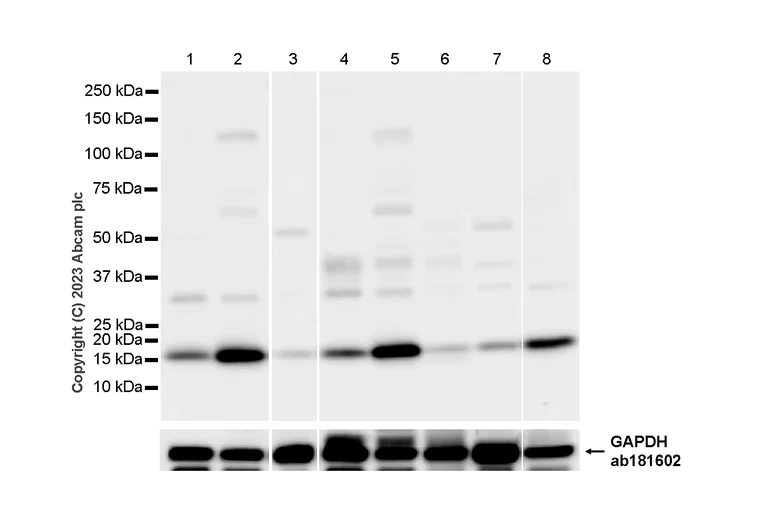 Western blot - Anti-UBE2I / UBC9 antibody [EP2938Y] (AB75854)