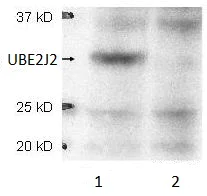 Western blot - Anti-UBE2J2 antibody (AB106097)