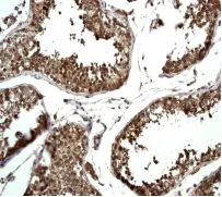 Immunohistochemistry (Formalin/PFA-fixed paraffin-embedded sections) - Anti-Ube2L3/UBCH7 antibody [EPR4368] - BSA and Azide free (AB247719)