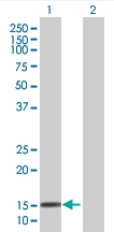 Western blot - Ube2L6 overexpression 293T lysate (whole cell) (AB94307), expandable thumbnail