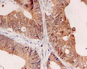 Immunohistochemistry (Formalin/PFA-fixed paraffin-embedded sections) - Anti-UBE2M/UBC12 antibody [EPR5333] (AB109507)