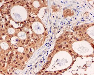 Immunohistochemistry (Formalin/PFA-fixed paraffin-embedded sections) - Anti-UBE2M/UBC12 antibody [EPR5333] - BSA and Azide free (AB236056)