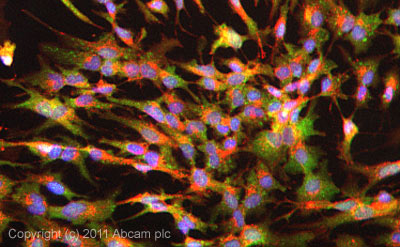 Immunocytochemistry/ Immunofluorescence - Anti-Ube2N / Ubc13 antibody (AB25885)