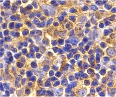Immunohistochemistry (Formalin/PFA-fixed paraffin-embedded sections) - Anti-Ube2N / Ubc13 antibody (AB25885)