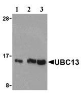 Western blot - Anti-Ube2N / Ubc13 antibody (AB25885)
