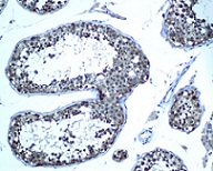 Immunohistochemistry (Formalin/PFA-fixed paraffin-embedded sections) - Anti-Ube2N / Ubc13 antibody [EPR5162] (AB109286)