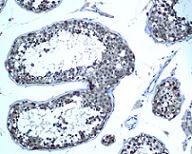 Immunohistochemistry (Formalin/PFA-fixed paraffin-embedded sections) - Anti-Ube2N / Ubc13 antibody [EPR5162] - BSA and Azide free (AB247818)