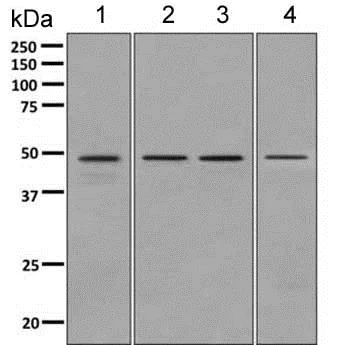 Western blot - Anti-UBE2Q2 antibody [EPR10229] - BSA and Azide free (AB249105)