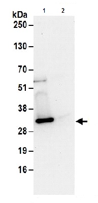 Immunoprecipitation - Anti-UBE2S antibody (AB177508), expandable thumbnail