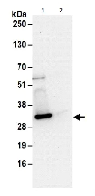 Immunoprecipitation - Anti-UBE2S antibody (AB177508)