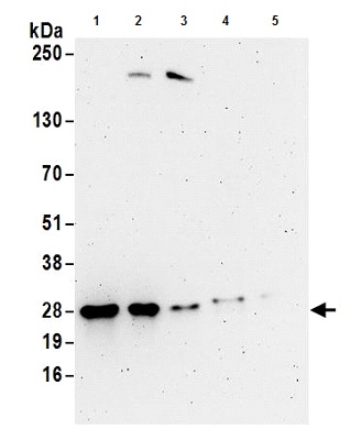 Western blot - Anti-UBE2S antibody (AB177508), expandable thumbnail