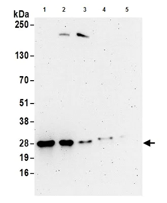 Western blot - Anti-UBE2S antibody (AB177508)