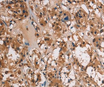 Immunohistochemistry (Formalin/PFA-fixed paraffin-embedded sections) - Anti-UBE2S antibody (AB197945), expandable thumbnail