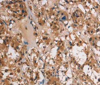 Immunohistochemistry (Formalin/PFA-fixed paraffin-embedded sections) - Anti-UBE2S antibody (AB197945)