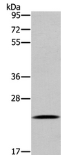 Western blot - Anti-UBE2S antibody (AB197945), expandable thumbnail