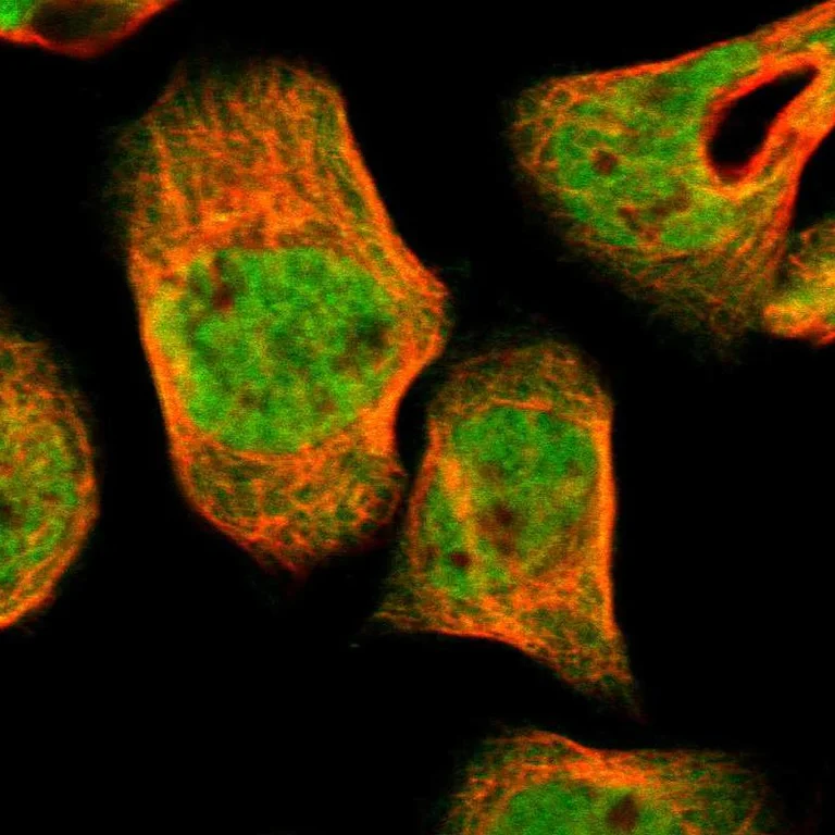 Immunocytochemistry/ Immunofluorescence - Anti-UBE2Z antibody (AB254700)