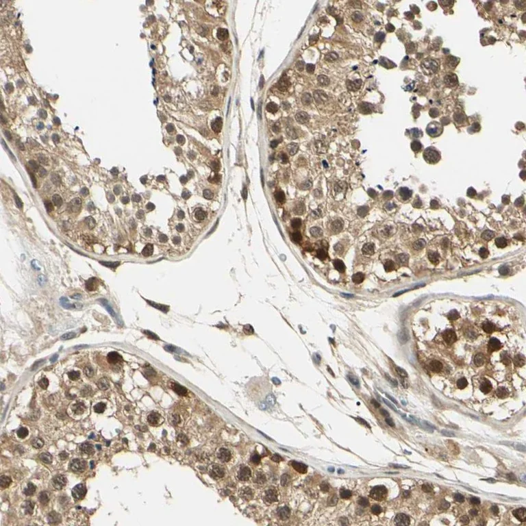 Immunohistochemistry (Formalin/PFA-fixed paraffin-embedded sections) - Anti-UBE2Z antibody (AB254700)