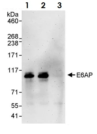 Immunoprecipitation - Anti-UBE3A antibody (AB10488)