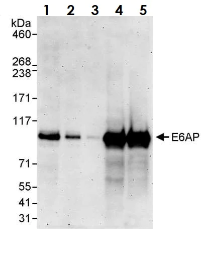 Western blot - Anti-UBE3A antibody (AB10488)