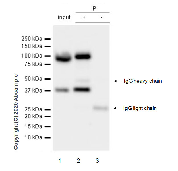 【Amina Amami】3箱セントラヴィ ENEW Active Bu Anti-UBE3A antibody [EPR23077-14] (ab272168) | Abcam