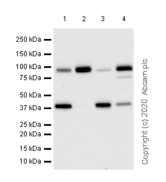 Western blot - Anti-UBE3A antibody [EPR23077-14] (AB272168)