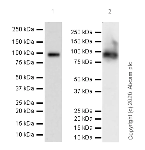 Western blot - Anti-UBE3A antibody [EPR23077-14] (AB272168)