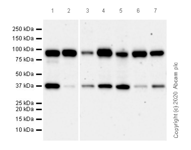 Western blot - Anti-UBE3A antibody [EPR23077-14] (AB272168)
