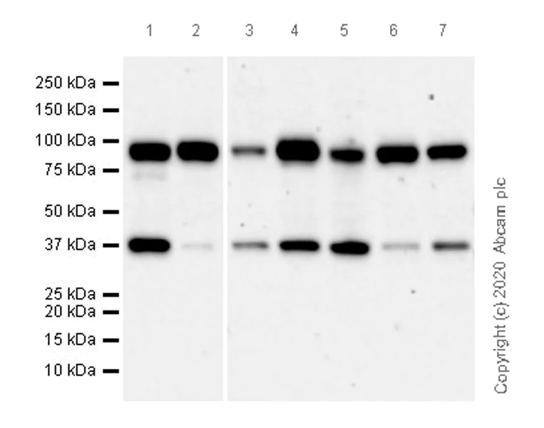 Western blot - Anti-UBE3A antibody [EPR23077-14] (AB272168)