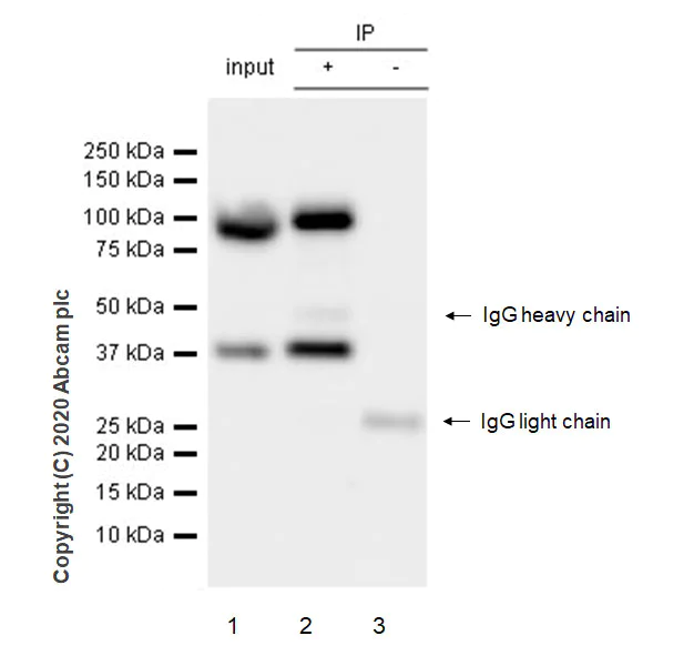 Immunoprecipitation - Anti-UBE3A antibody [EPR23077-14] - BSA and Azide free (AB272173)