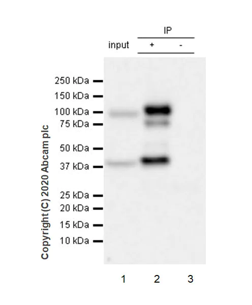 Immunoprecipitation - Anti-UBE3A antibody [EPR23077-14] - BSA and Azide free (AB272173)