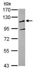 Western blot - Anti-UBE3C antibody (AB101512), expandable thumbnail
