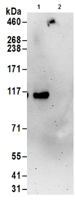 Immunoprecipitation - Anti-UBE3C antibody (AB177511)