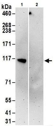 Immunoprecipitation - Anti-UBE3C antibody (AB226173)