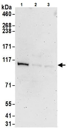 Western blot - Anti-UBE3C antibody (AB226173)