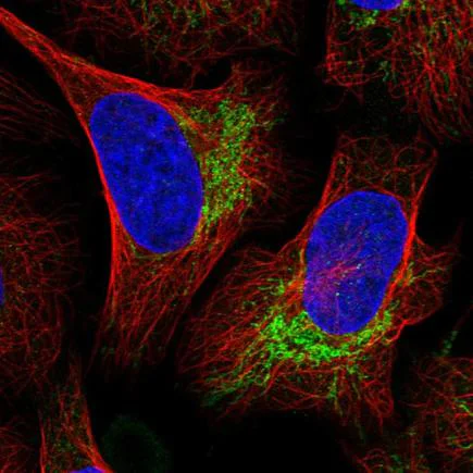 Immunocytochemistry - Anti-UBE3C antibody (AB243830)