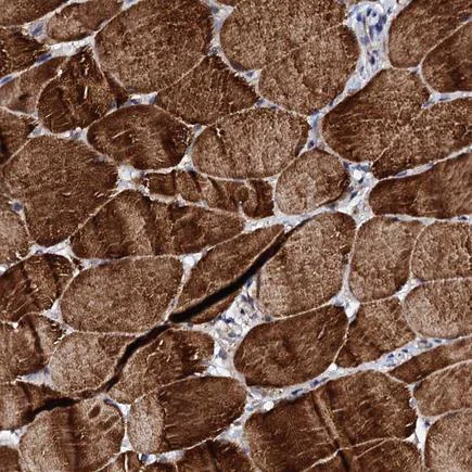 Immunohistochemistry (Formalin/PFA-fixed paraffin-embedded sections) - Anti-UBE3C antibody (AB243830)