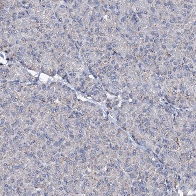 Immunohistochemistry (Formalin/PFA-fixed paraffin-embedded sections) - Anti-UBE3C antibody (AB243830)
