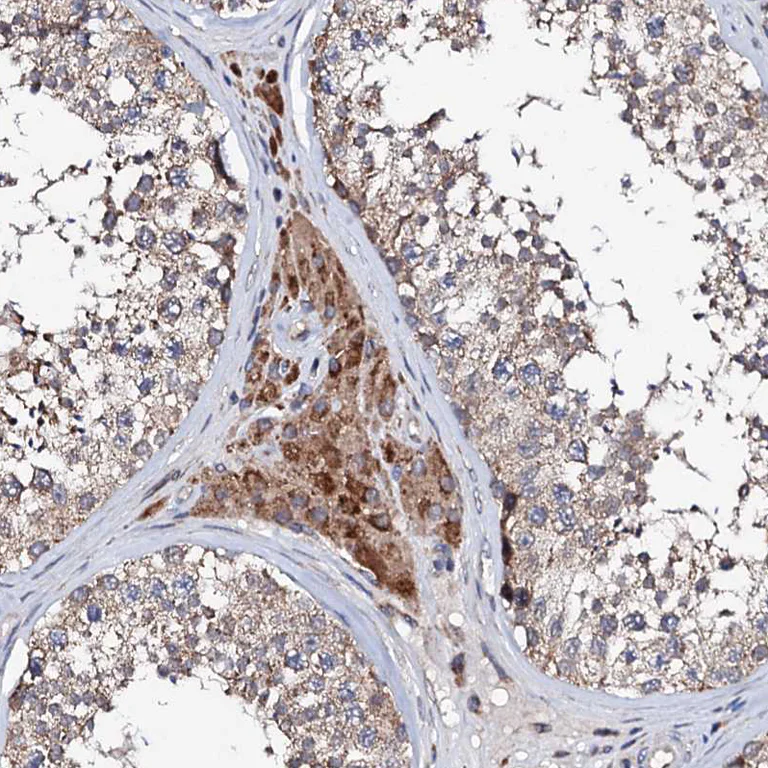 Immunohistochemistry (Formalin/PFA-fixed paraffin-embedded sections) - Anti-UBE3C antibody (AB243830)