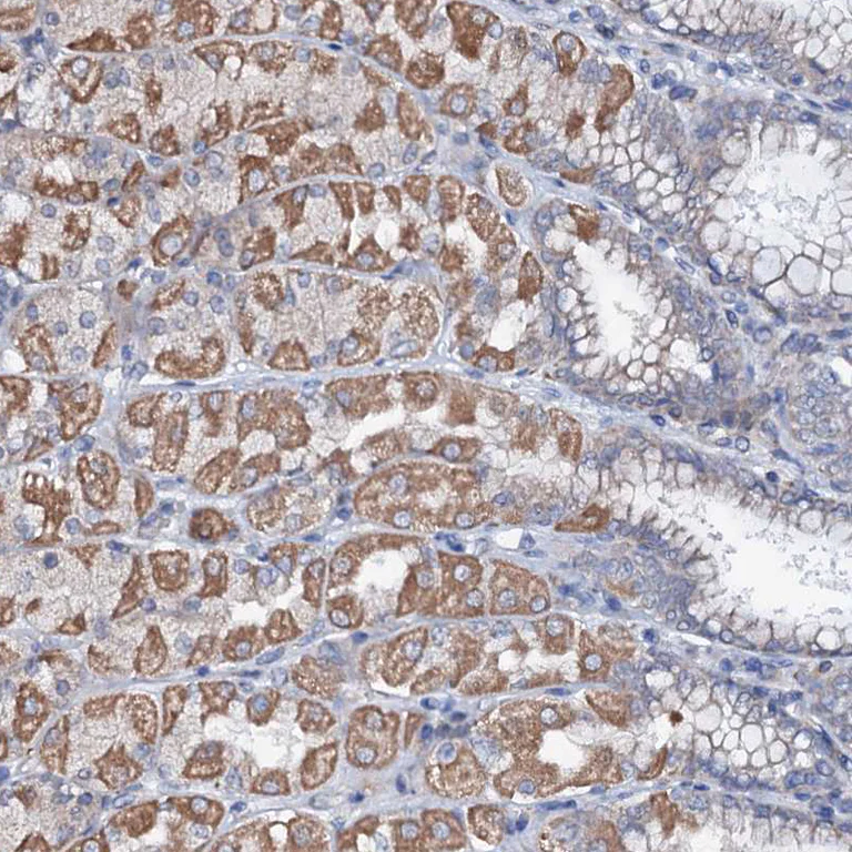 Immunohistochemistry (Formalin/PFA-fixed paraffin-embedded sections) - Anti-UBE3C antibody (AB243830)