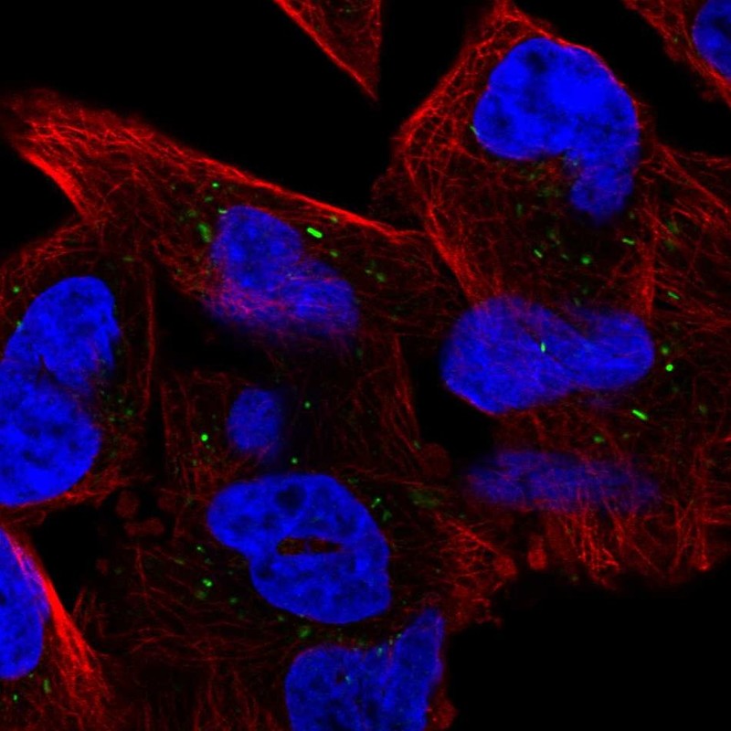 Immunocytochemistry - Anti-UBE3D antibody (AB121927), expandable thumbnail