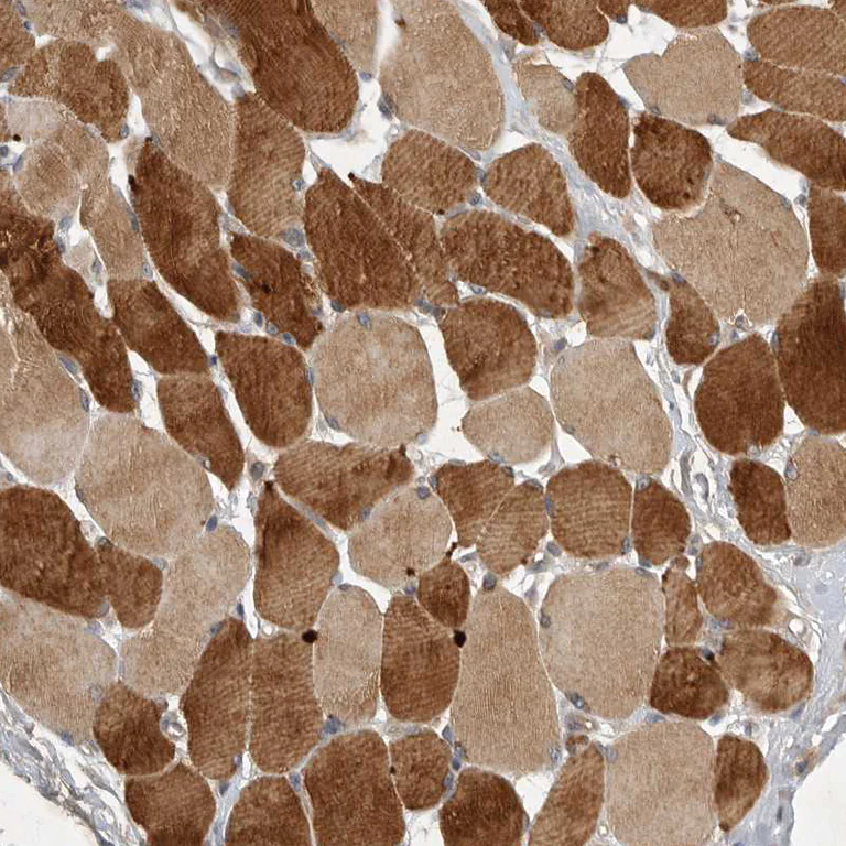 Immunohistochemistry (Formalin/PFA-fixed paraffin-embedded sections) - Anti-UBE3D antibody (AB121927)