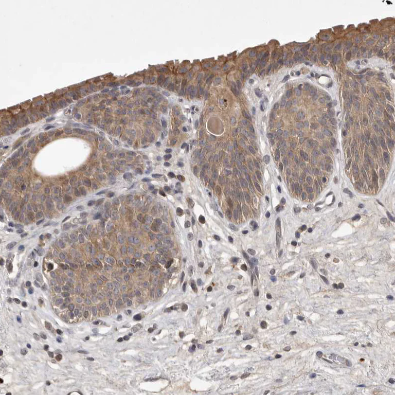 Immunohistochemistry (Formalin/PFA-fixed paraffin-embedded sections) - Anti-UBE3D antibody (AB121927)