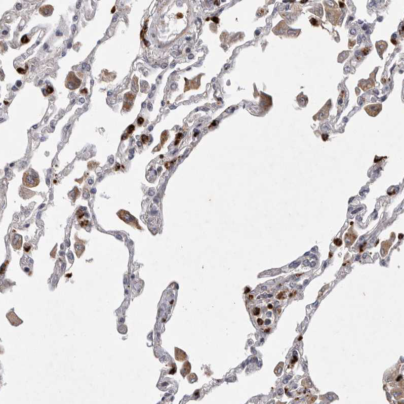 Immunohistochemistry (Formalin/PFA-fixed paraffin-embedded sections) - Anti-UBE3D antibody (AB121927), expandable thumbnail