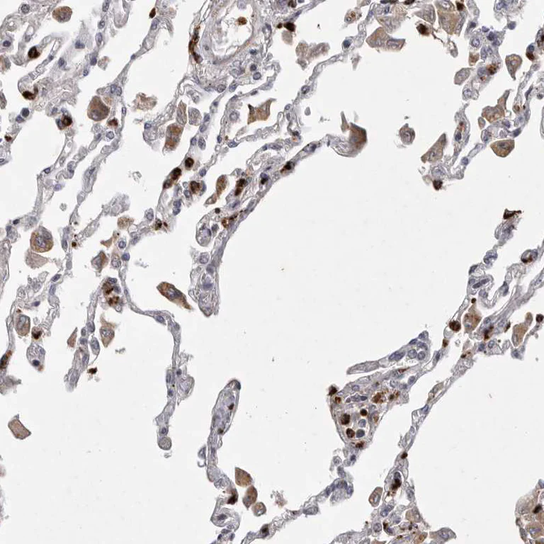 Immunohistochemistry (Formalin/PFA-fixed paraffin-embedded sections) - Anti-UBE3D antibody (AB121927)