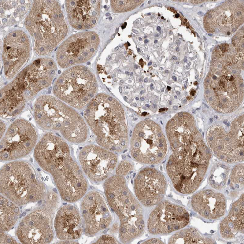 Immunohistochemistry (Formalin/PFA-fixed paraffin-embedded sections) - Anti-UBE3D antibody (AB121927), expandable thumbnail